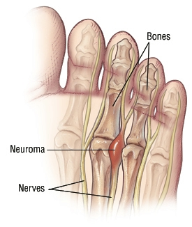Shoes Hurt Second Last Toe Shoes Hurt Second Last Toe